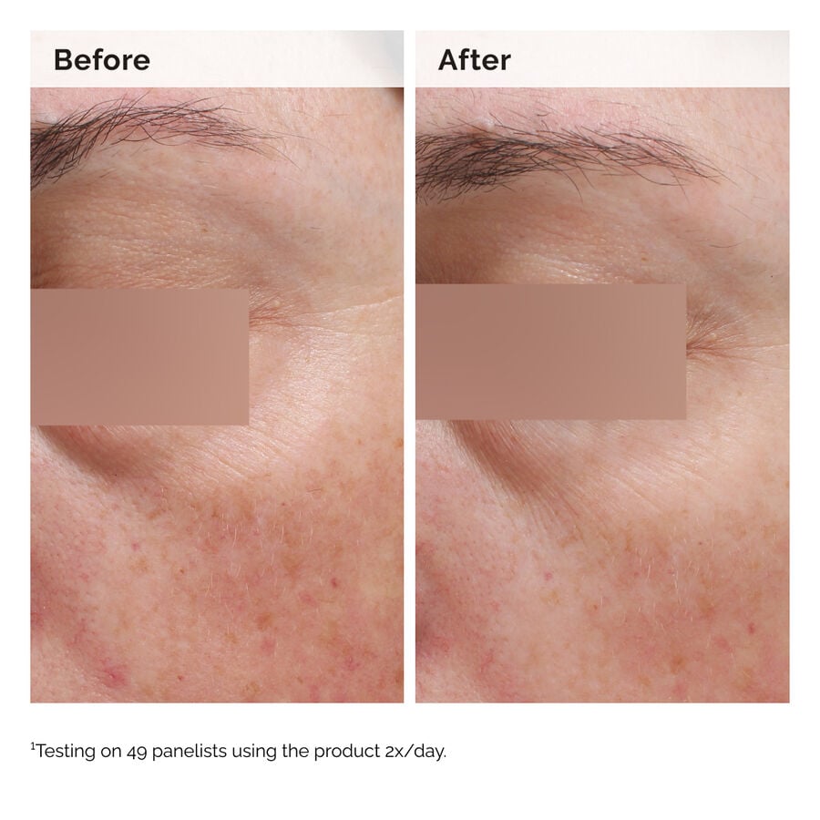 niacinamide-5-face-and-body-emulsion-z9 2024-08-23-ORD-Nia-5pct-Face-Body-B-A-Elasticity-Global-02-1x1.jpg