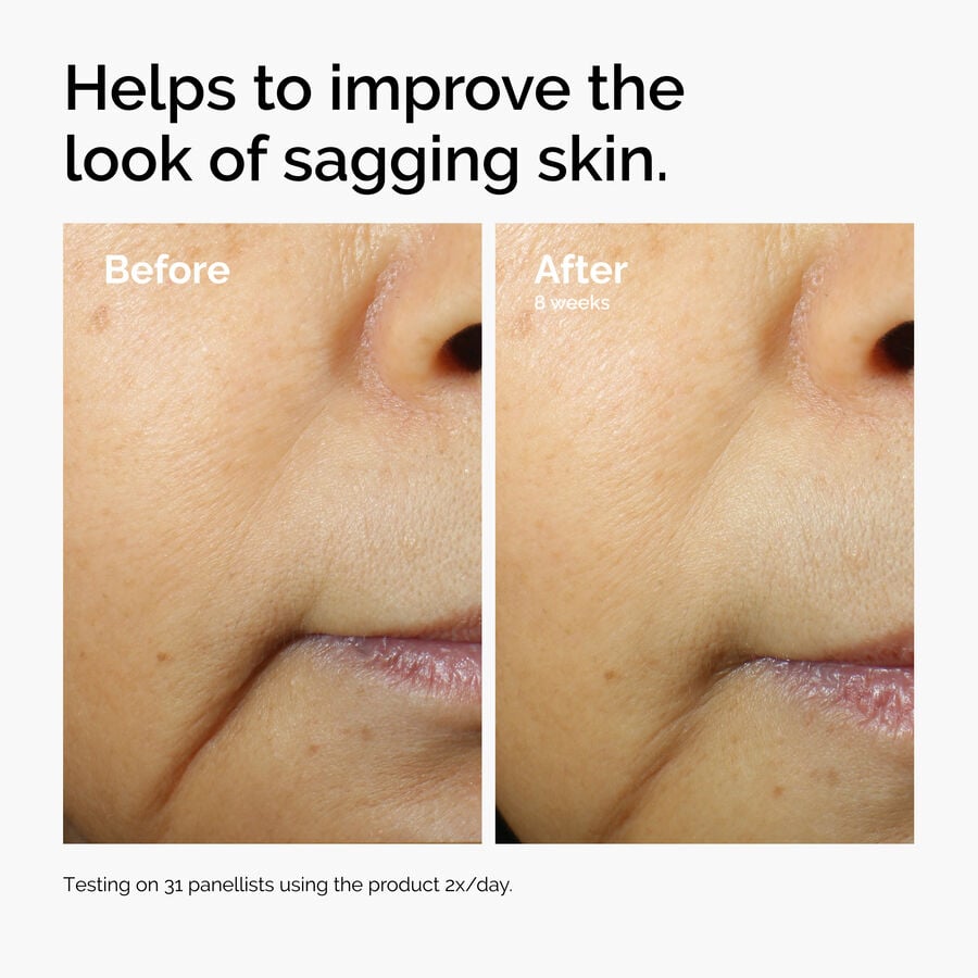 caffeine-3-escin-1-face-serum-f2 ord-caffeine-3pct-escin-1pct-face-serum-before-after-sagging.jpg