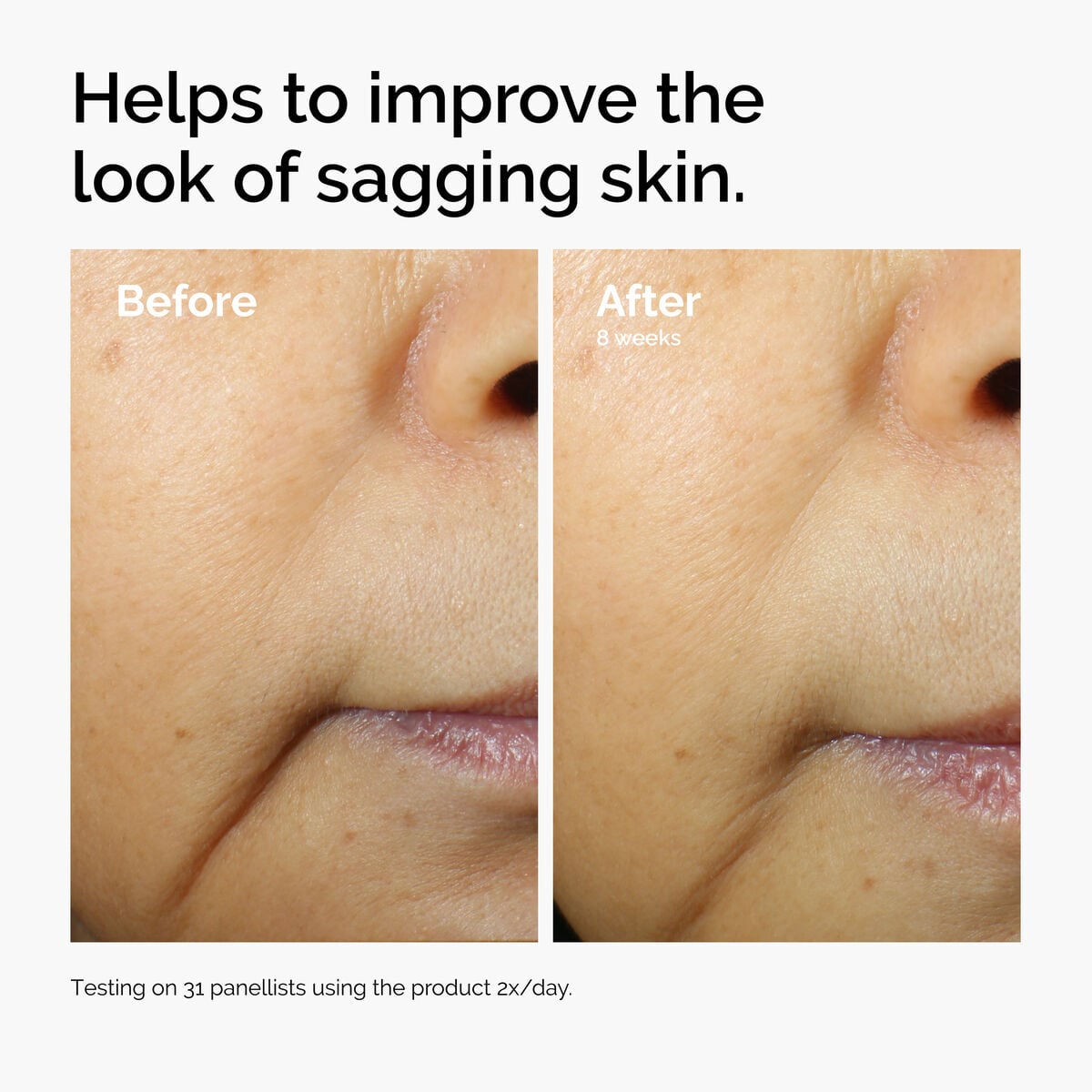 caffeine-3-escin-1-face-serum-f2 ord-caffeine-3pct-escin-1pct-face-serum-before-after-sagging.jpg