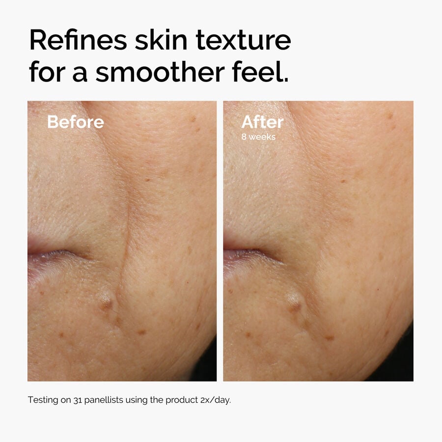 caffeine-3-escin-1-face-serum-f2 ord-caffeine-3pct-escin-1pct-face-serum-before-after-texture.jpg
