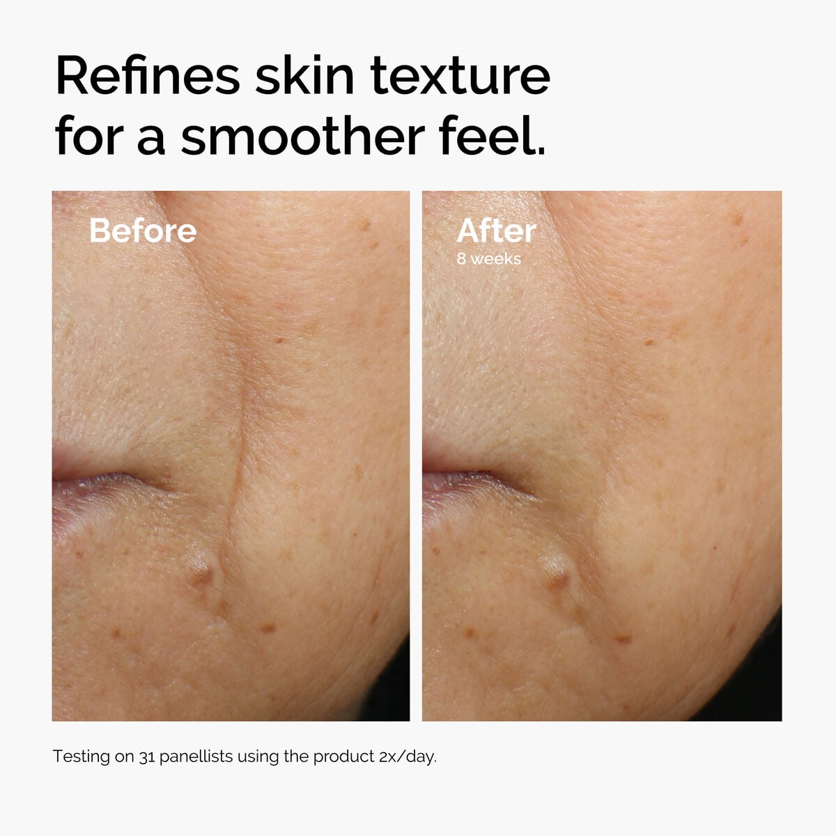 caffeine-3-escin-1-face-serum-f2 ord-caffeine-3pct-escin-1pct-face-serum-before-after-texture.jpg