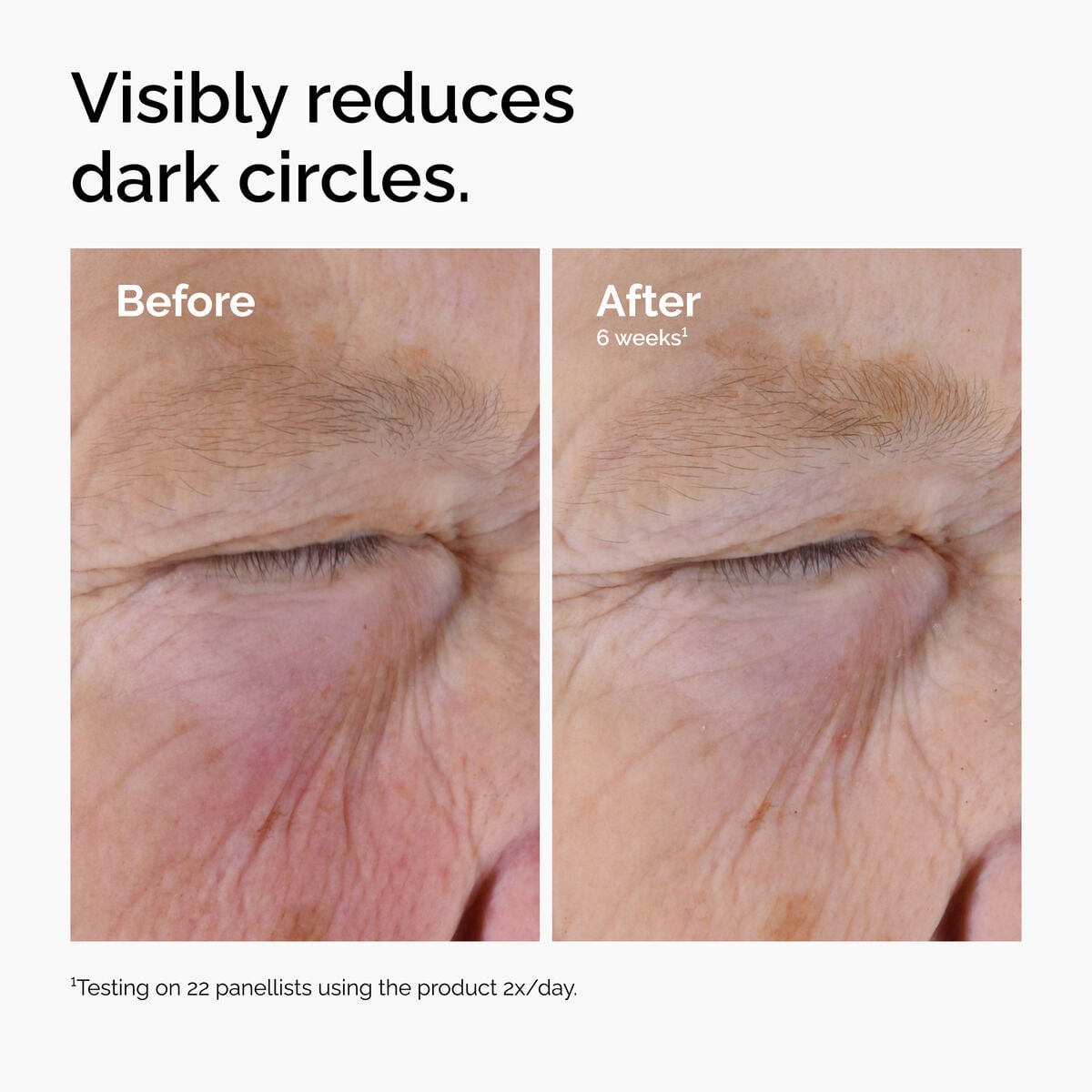 caffeine-solution-5-egcg-eye-serum-k8 ord-caffeine-solution-egcg-dark-circles-before-after.jpg