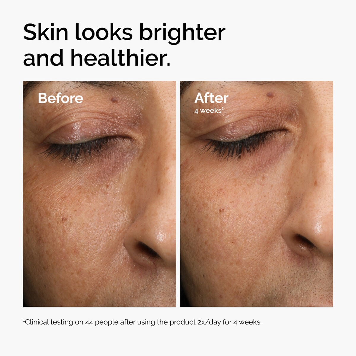 multi-antioxidant-radiance-serum-h9 ord-mars-before-after-healthy.jpg