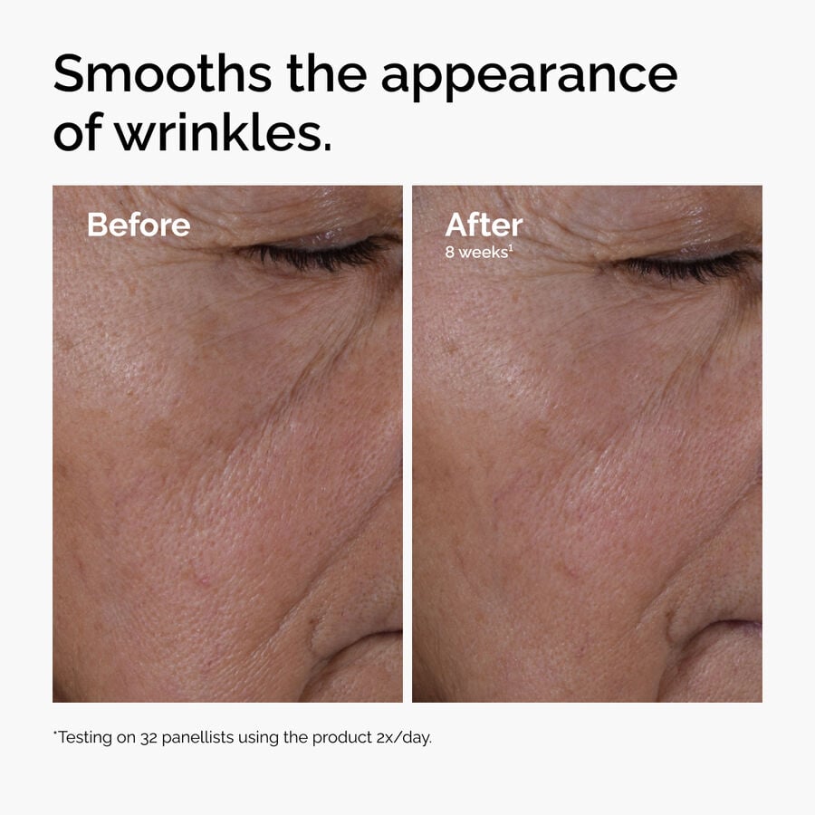 multi-peptide-ha-serum-b8 ord-multi-peptide-ha-serum-wrinkles-before-after.jpg