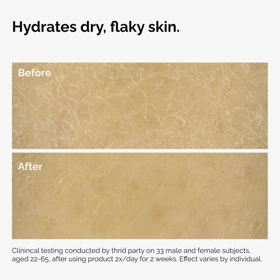 the-body-care-collection-x0 ord-natural-moisturizing-factors-inulin-body-before-after-graphic-02.jpg