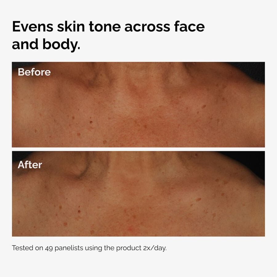 the-body-care-collection-x0 ord-niacinamide-face-body-serum-before-after-even-tone-graphic.jpg